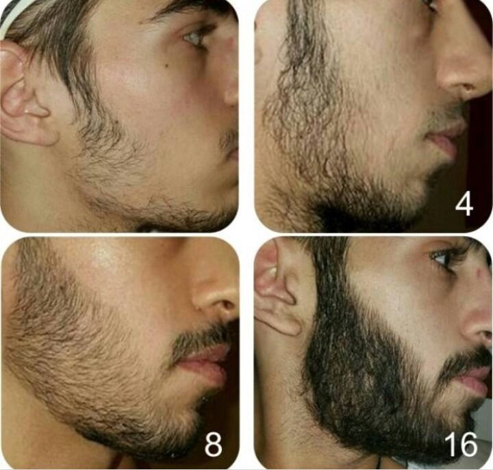 Не растёт борода, что делать? Что применять, чтобы росла борода